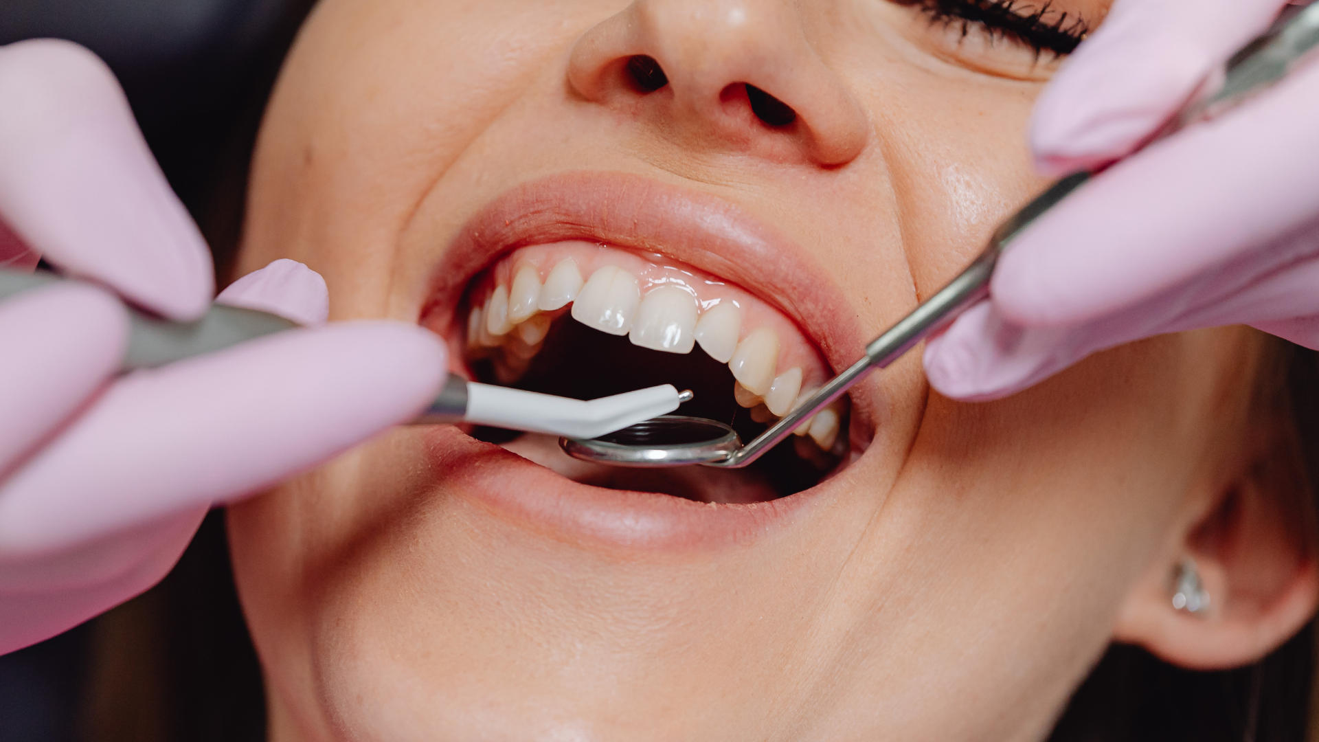 Hyde Park Dental Care Provides Comprehensive, Patient-Focused Dental Services in Sydney CBD