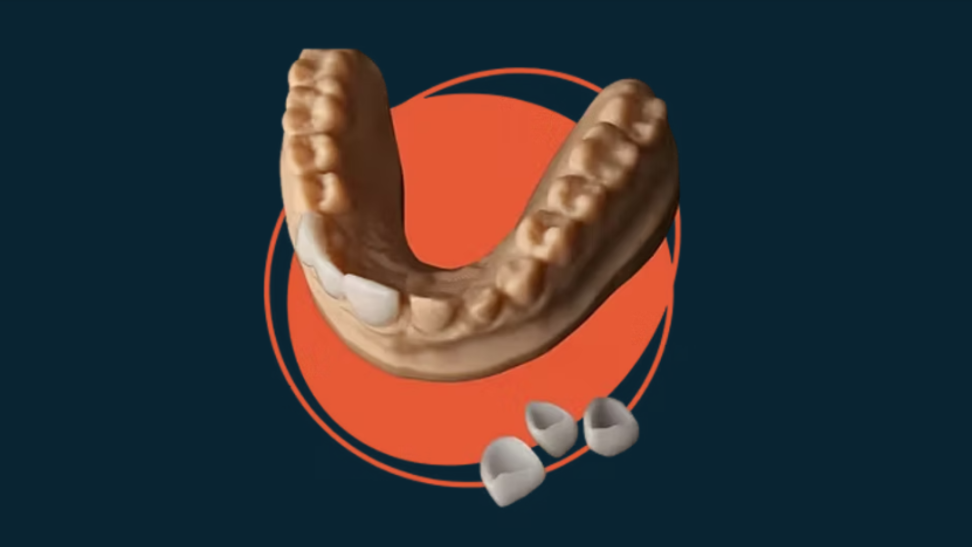 iDD Dental Lab Offers Digital Dental Laboratory Services to Practices Across New Zealand